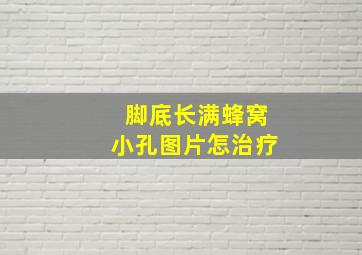 脚底长满蜂窝小孔图片怎治疗