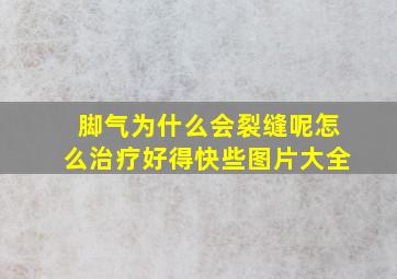 脚气为什么会裂缝呢怎么治疗好得快些图片大全