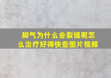 脚气为什么会裂缝呢怎么治疗好得快些图片视频