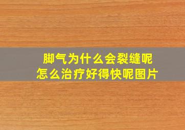 脚气为什么会裂缝呢怎么治疗好得快呢图片