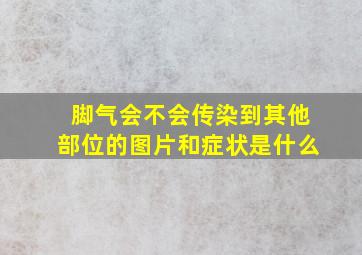 脚气会不会传染到其他部位的图片和症状是什么