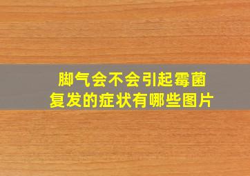 脚气会不会引起霉菌复发的症状有哪些图片