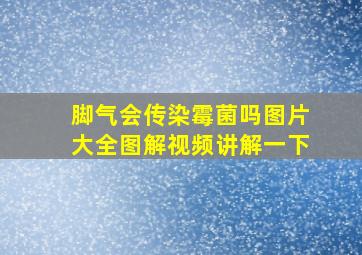 脚气会传染霉菌吗图片大全图解视频讲解一下