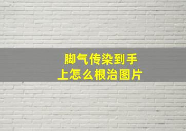 脚气传染到手上怎么根治图片