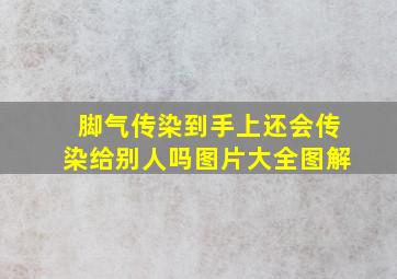 脚气传染到手上还会传染给别人吗图片大全图解