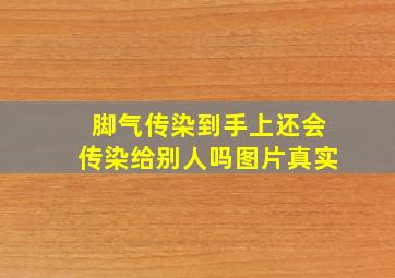 脚气传染到手上还会传染给别人吗图片真实