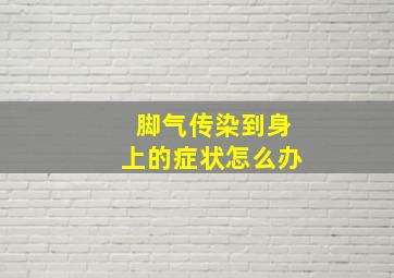 脚气传染到身上的症状怎么办