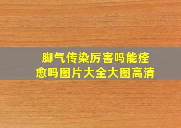 脚气传染厉害吗能痊愈吗图片大全大图高清