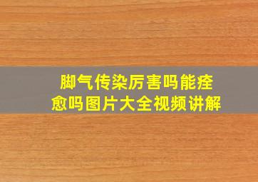 脚气传染厉害吗能痊愈吗图片大全视频讲解