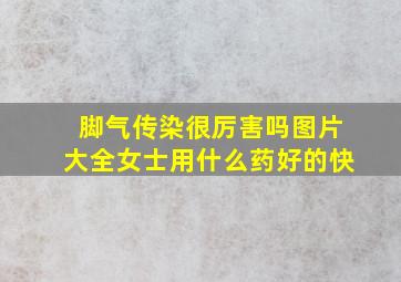 脚气传染很厉害吗图片大全女士用什么药好的快