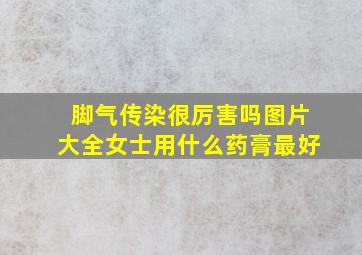 脚气传染很厉害吗图片大全女士用什么药膏最好