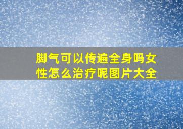 脚气可以传遍全身吗女性怎么治疗呢图片大全