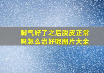 脚气好了之后脱皮正常吗怎么治好呢图片大全