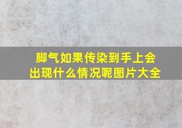 脚气如果传染到手上会出现什么情况呢图片大全