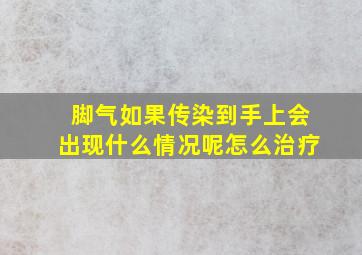 脚气如果传染到手上会出现什么情况呢怎么治疗