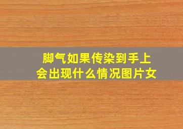 脚气如果传染到手上会出现什么情况图片女