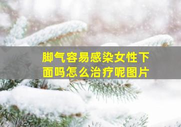 脚气容易感染女性下面吗怎么治疗呢图片