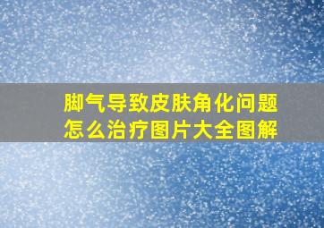 脚气导致皮肤角化问题怎么治疗图片大全图解