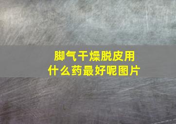 脚气干燥脱皮用什么药最好呢图片