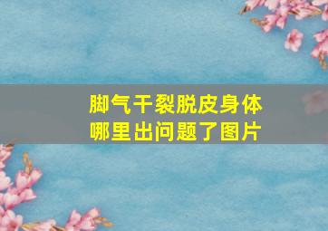 脚气干裂脱皮身体哪里出问题了图片