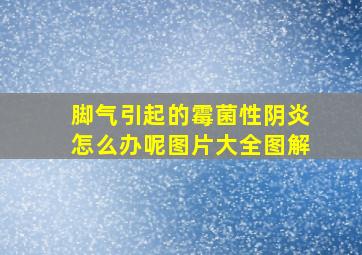 脚气引起的霉菌性阴炎怎么办呢图片大全图解