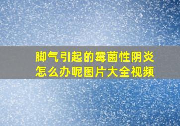 脚气引起的霉菌性阴炎怎么办呢图片大全视频