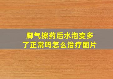 脚气擦药后水泡变多了正常吗怎么治疗图片