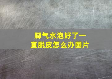 脚气水泡好了一直脱皮怎么办图片