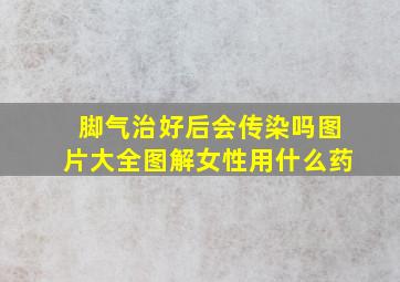 脚气治好后会传染吗图片大全图解女性用什么药