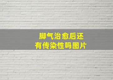 脚气治愈后还有传染性吗图片