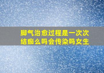 脚气治愈过程是一次次结痂么吗会传染吗女生