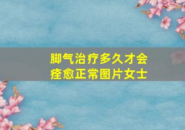 脚气治疗多久才会痊愈正常图片女士