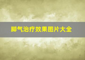 脚气治疗效果图片大全