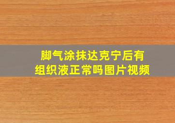 脚气涂抹达克宁后有组织液正常吗图片视频