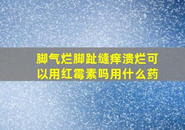 脚气烂脚趾缝痒溃烂可以用红霉素吗用什么药