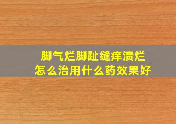 脚气烂脚趾缝痒溃烂怎么治用什么药效果好