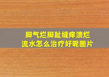 脚气烂脚趾缝痒溃烂流水怎么治疗好呢图片