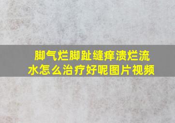 脚气烂脚趾缝痒溃烂流水怎么治疗好呢图片视频