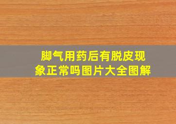 脚气用药后有脱皮现象正常吗图片大全图解