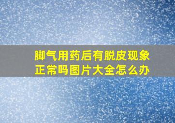 脚气用药后有脱皮现象正常吗图片大全怎么办