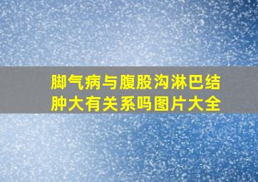 脚气病与腹股沟淋巴结肿大有关系吗图片大全