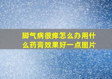 脚气病很痒怎么办用什么药膏效果好一点图片