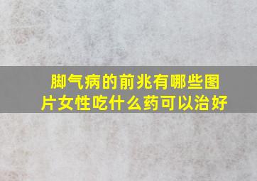 脚气病的前兆有哪些图片女性吃什么药可以治好