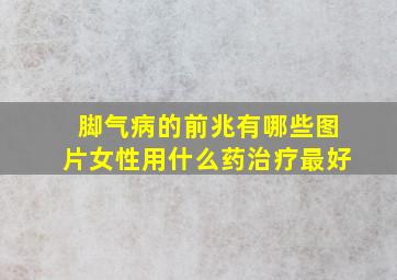 脚气病的前兆有哪些图片女性用什么药治疗最好