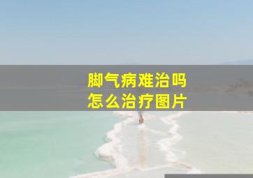 脚气病难治吗怎么治疗图片