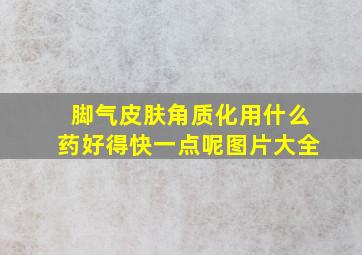 脚气皮肤角质化用什么药好得快一点呢图片大全