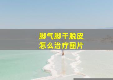 脚气脚干脱皮怎么治疗图片