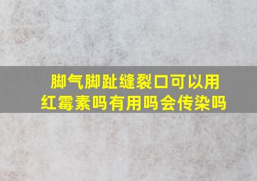 脚气脚趾缝裂口可以用红霉素吗有用吗会传染吗