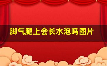 脚气腿上会长水泡吗图片