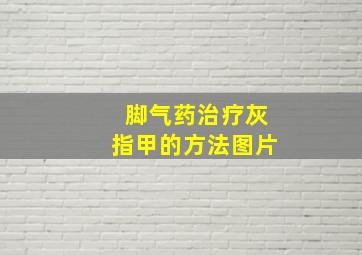 脚气药治疗灰指甲的方法图片